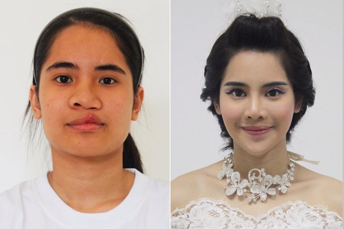 Co gai ho ham ech xinh nhu hot girl nho phau thuat tham my hinh anh