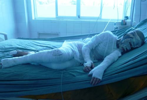 Khoi to ke tat axit ca gia dinh trong bua toi hinh anh