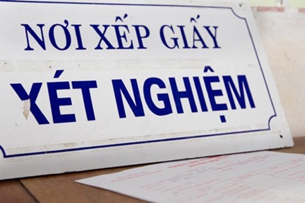 Xet nghiem nuoc tieu cung bi ‘nhan ban’ hinh anh