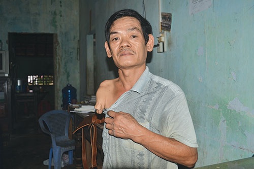 Su that nguoi cut chan, tay co bang lai xe hinh anh