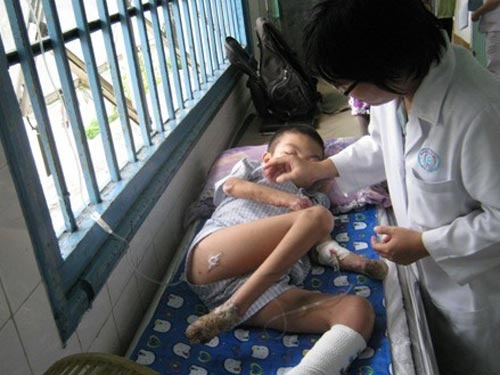 Chang trai mac benh rung dan tu chi hinh anh