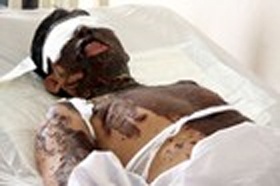 Can bo thue tat axit vao Viet kieu Uc hinh anh