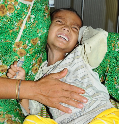 Be 8 tuoi nang 7 kg hinh anh