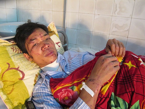 Thay giao nghen ngao ke lai phut mat con trong lu hinh anh