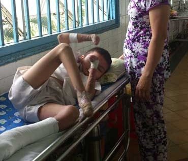 Chang trai rung dan tu chi khong the co bao hiem hinh anh