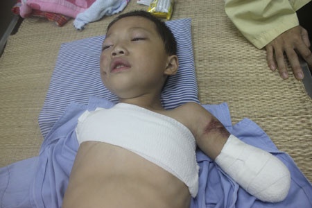 Be trai 5 tuoi bi gau can dut lia tay o Phu Tho hinh anh