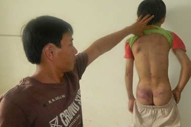 Nguoi cha bao hanh con ruot linh 18 thang tu hinh anh