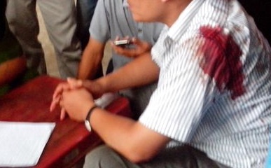 CSGT no sung, mot nguoi chay xe may bi thuong hinh anh