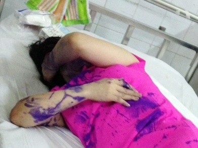 Mot phu nu bi danh dap, do muc vao mom giua pho hinh anh