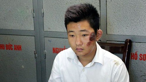 Loi khai cua bao ve giup bac si vut xac xuong song hinh anh