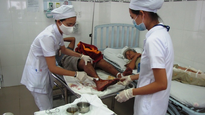 1 nguoi chet, 31 bi thuong trong vu xe khach huc nhau hinh anh