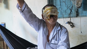 Nguoi dan ong hoa mat quy chi vi tay not ruoi hinh anh