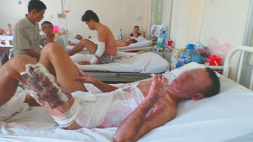 Noi dau cua nguoi dan ong bi thieu song hinh anh