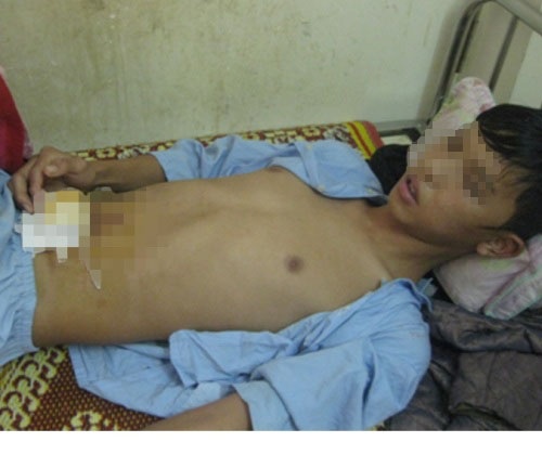 Den tham ban gai, bi dam thung ruot hinh anh