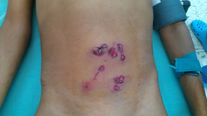 Cuu be trai 9 tuoi bi 10 vet thuong do sung tu che hinh anh