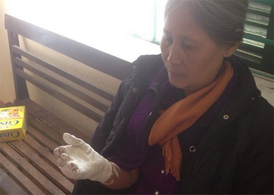 Tu choi ‘boa’, khach du lich bi danh gay tay hinh anh