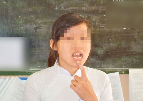 Xu ly viec cong an thi tran danh nu sinh gay rang hinh anh