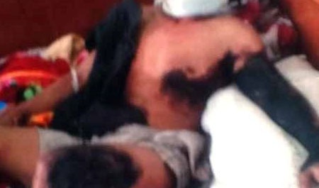 Mac bong den, bi dien cao the giat chay sem nua nguoi hinh anh