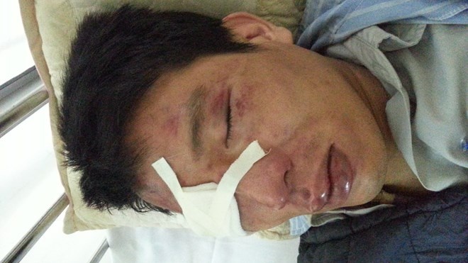 Nhan vien ban ve xe buyt bi hanh hung da man hinh anh
