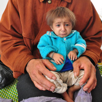 Be trai 5 tuoi nang 3kg o Quang Ngai hinh anh