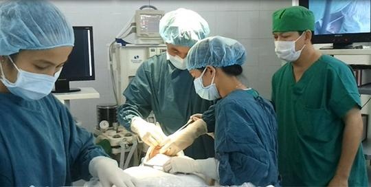 Noi thanh cong mui dut roi hoan toan hinh anh