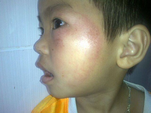 Me hieu truong danh bam dap tre mam non hinh anh