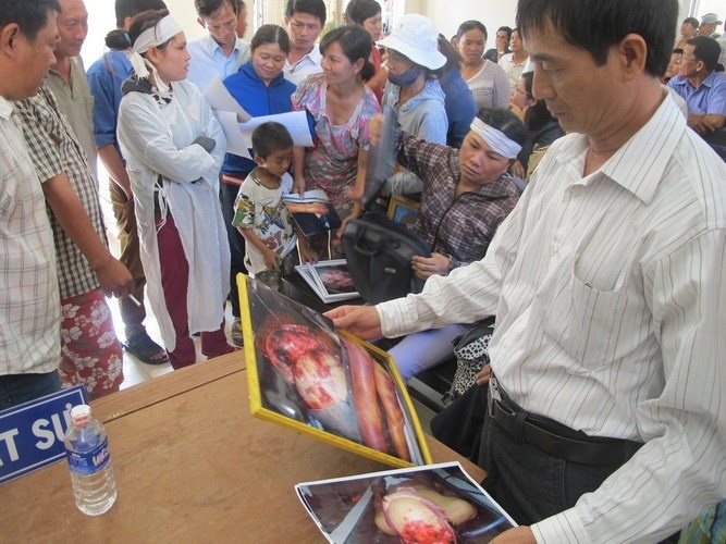   Những vết thương nghiêm trọng trên cơ thể nạn nhân Kiều khiến người ngoài cũng phải ghê sợ.