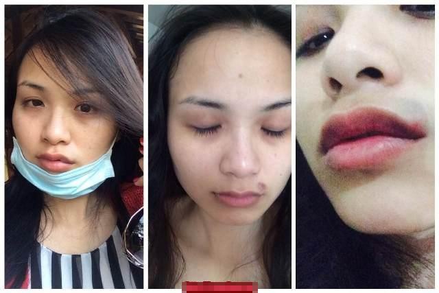 Tương tự với Ngọc Thúy, hoa hậu Dễm Hương cũng găp phải người chồng vũ phu. Sau khi bị lật tẩy sự việc đã kết hôn, Diễm Hương tự đăng tải hình ảnh mình bị chồng cũ hành hung. Cô tố chồng cũ nhiều lần đánh mình. 