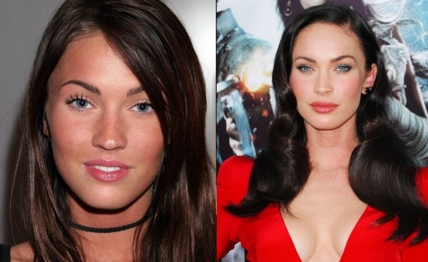 Nhung ngoi sao xau hon sau khi 'dong dao keo' hinh anh