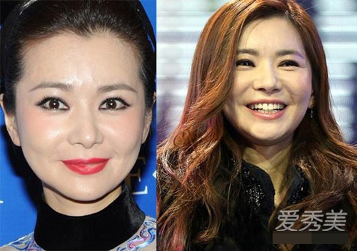 Nữ diễn viên Hàn Quốc Jang Seo-hee mượn dao kéo để níu giữ tuổi xuân