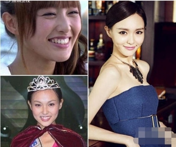 Trong loạt ảnh này có thể thấy khi đó, Đường Yên năm 18 tuổi có gương mặt khá bình thường với đôi mắt nhỏ và răng khấp khểnh. Hiện nay, Đường Yên có tuổi hơn nhưng lại đẹp và ngày càng nổi tiếng. Chính vì sự khác biệt này, Đường Yên bị nghi vấn đã thẩm mỹ chỉnh răng và mắt. 