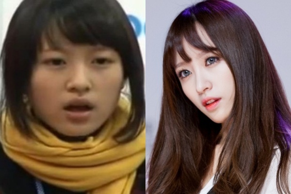 Là gương mặt đang được chú ý hiện nay, quá khứ của Hani (EXID) luôn khiến cả cộng đồng Kpop quan tâm. Mới đây, đoạn clip Hani thi tuyển vào JYP bị “đào mộ” và nhan sắc thời điểm 16 tuổi của cô nàng trở thành đề tài bình luận sôi nổi. Một vài cư dân mạng nhận xét vẻ ngoài Hani quá đỗi tầm thường và đặt ra nghi vấn “dao kéo” đối với nữ thần tượng.