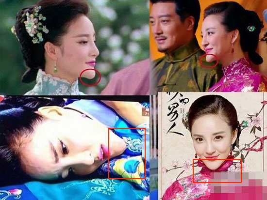 Nhưng do sa đà vào thẩm mỹ, cô đã phải 