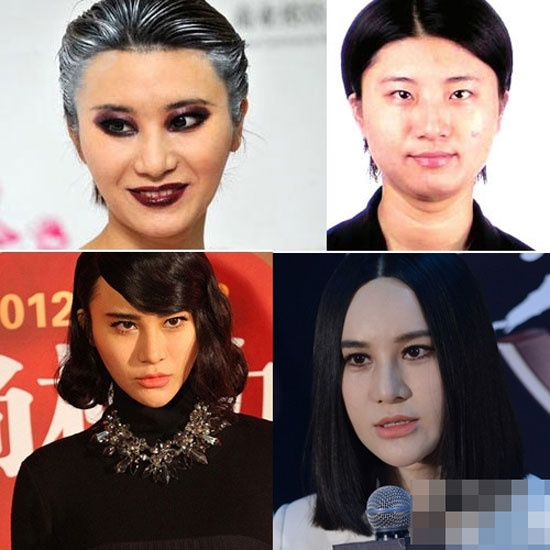 Nhưng do sa đà vào thẩm mỹ, cô đã phải 