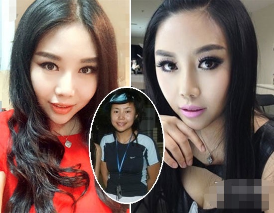 So với thời chưa thẩm mỹ, cô như hai con người hoàn toàn khác biệt.