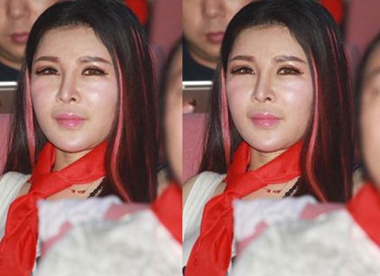 Gương mặt cô trong một sự kiện gần đây sưng phồng và xuống cấp trầm trọng.