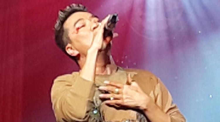 Dam Vinh Hung bi tai nan chay mau mat tren san khau hinh anh