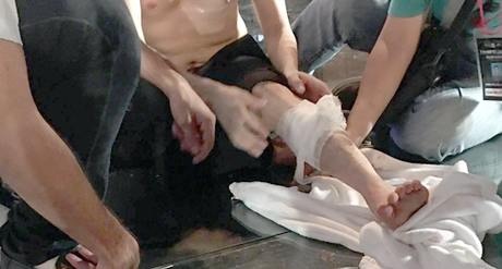 Dam Vinh Hung gap tai nan ngay truoc them live show hinh anh