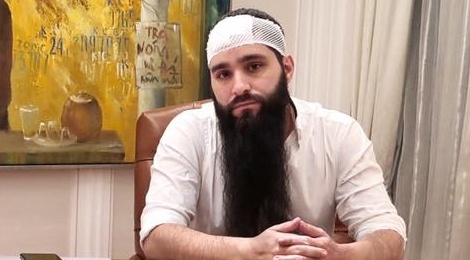 Dao dien 'Kong' noi ve vu hanh hung: 'Thu pham la nhung ten con do' hinh anh