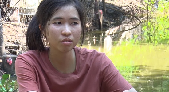 Gia canh ngheo cua co gai co guong mat bat bien o Thach thuc danh hai hinh anh