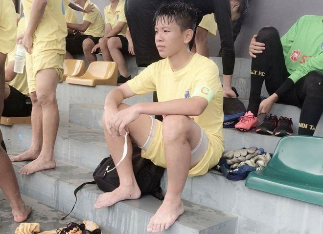 Cau thu bi doa cat gan chan anh 1