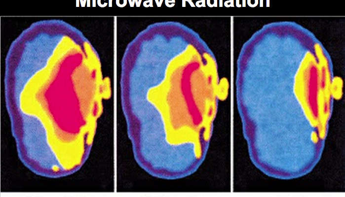 tác hại của điện thoại, ảnh hưởng của điện thoại, điện thoại gây ưng thư ảnh 1 tac hai cua dien thoai, anh huong cua dien thoai, dien thoai gay ung thu anh 1