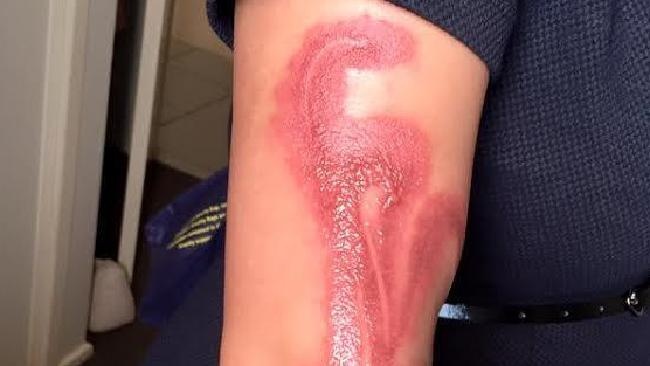 Bi bong cap do 2 vi iPhone 7 hinh anh