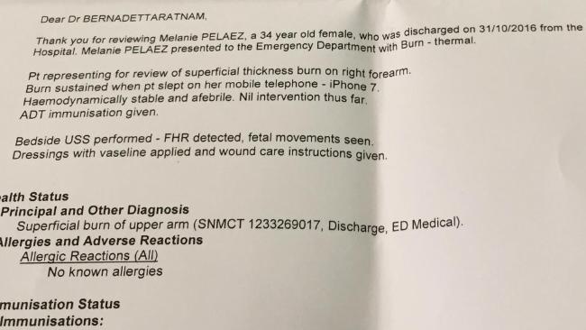 Bong vi iPhone 7 anh 2