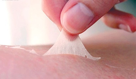 Troc da ban tay la benh gi? hinh anh