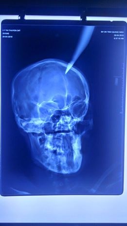 phu nu co thai anh 2