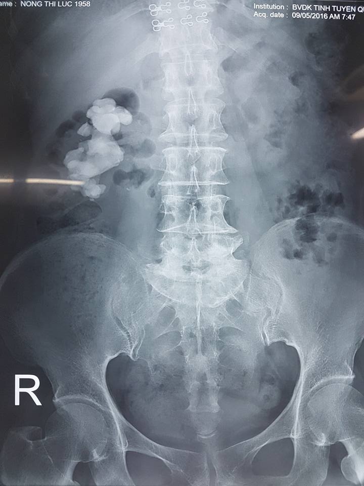 thuốc nam ảnh 1 thuoc nam anh 1