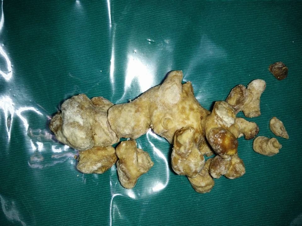 Uong thuoc nam thay nuoc, dinh soi san ho 10 cm hinh anh