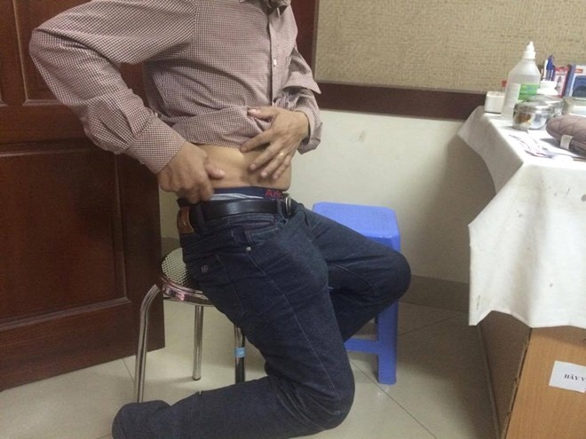 sán lá gan ảnh 2 san la gan anh 2