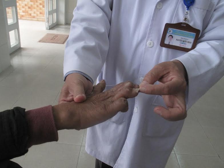 bệnh phong ảnh 2 benh phong anh 2